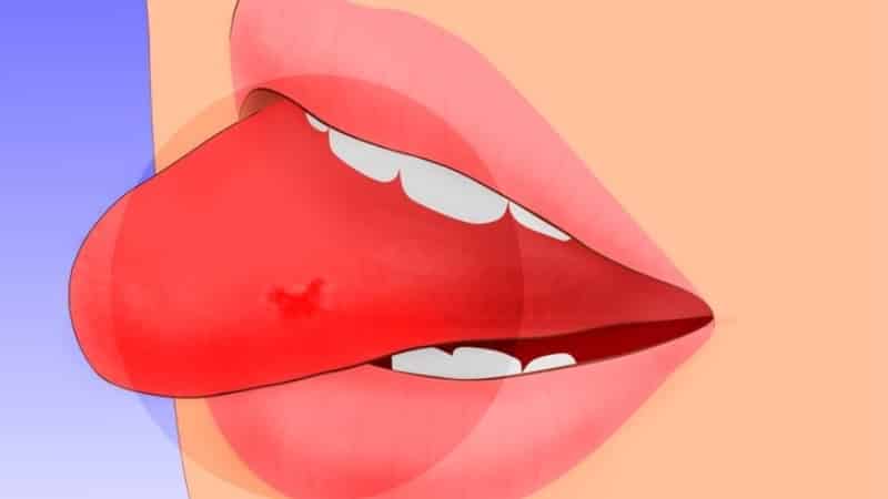 как остановить кровь из языка