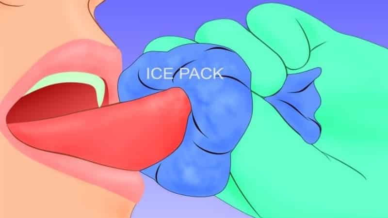 ребенок прикусил язык до крови что делать