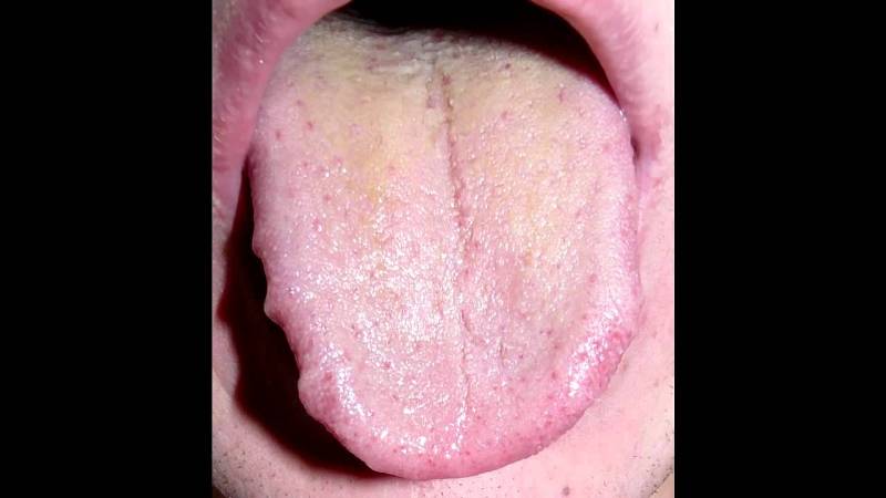 щетка для чистки языка фото