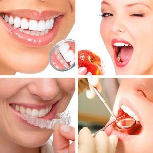 Как проходит лечение каппами Invisalign