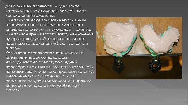 Как работать с гипсом в стоматологии