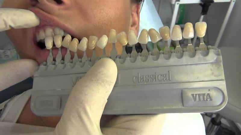 больно ли ставить коронку на зуб