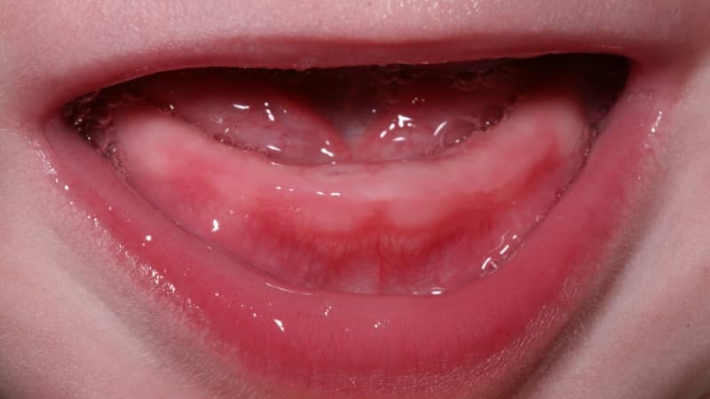 как узнать коренной зуб или молочный