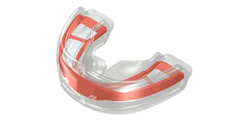 Как выровнять зубы в домашних условиях трейнерами