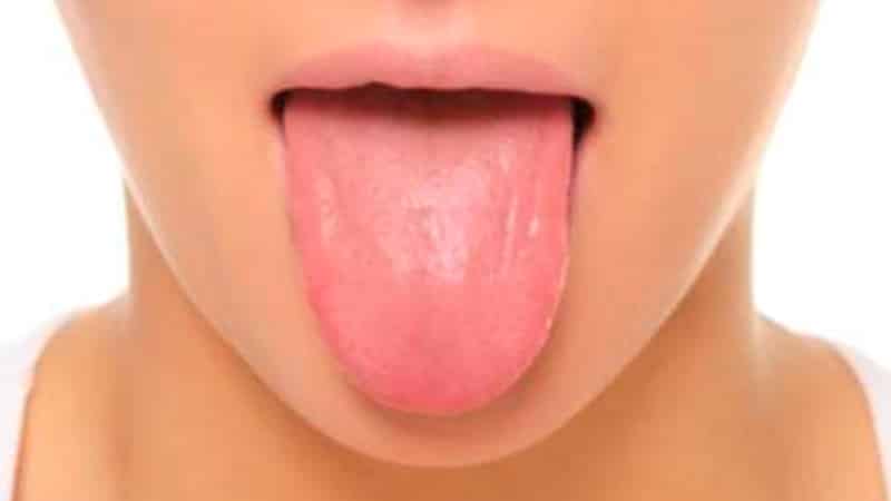 как выглядит здоровый язык фото