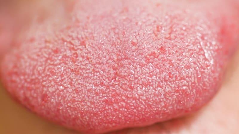 какой должен быть язык у здорового человека