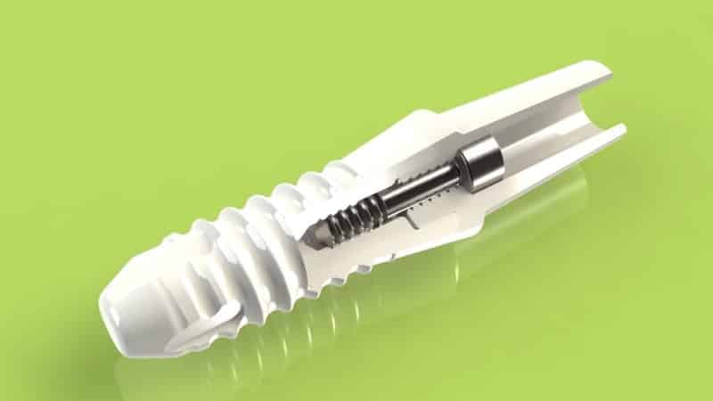 какие зубные импланты самые лучшие