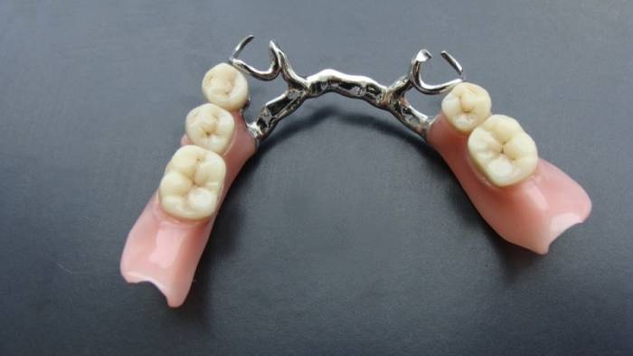 протезы зубов съемные протезы