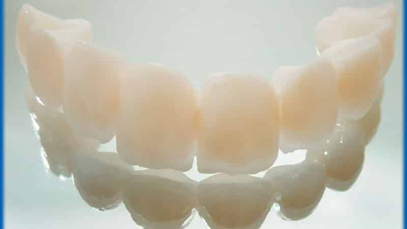 сколько стоит пластмассовая коронка на зуб отзывы