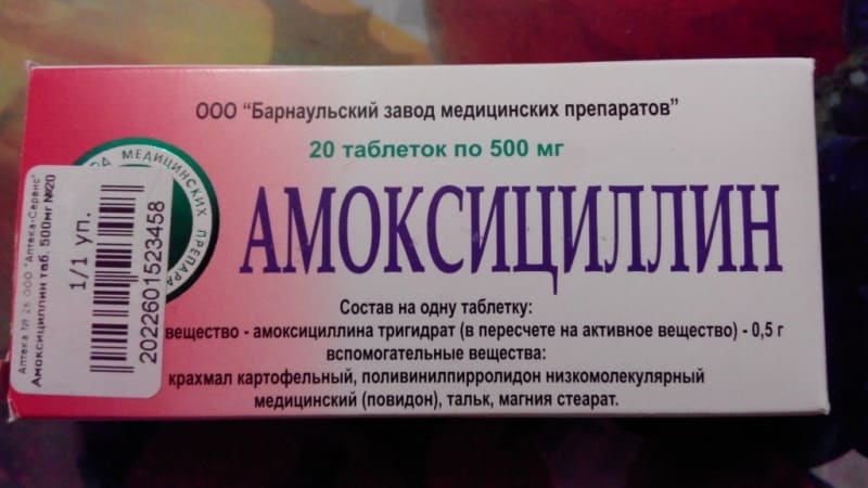 киста корня зуба симптомы лечение