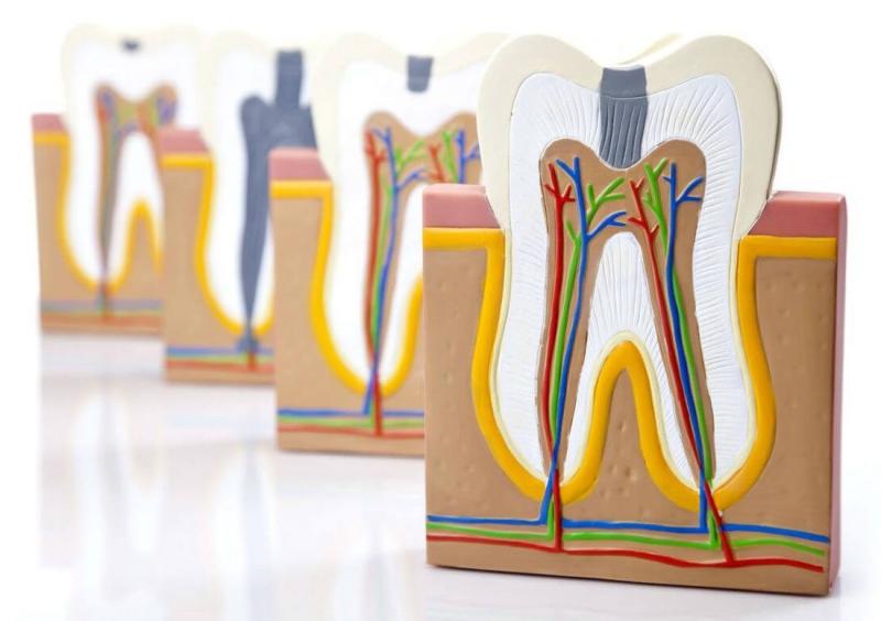 корень зуба фото