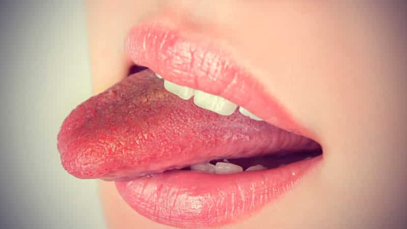 Коричневый налет