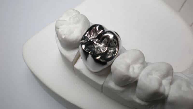 коронка на зуб фото до и после