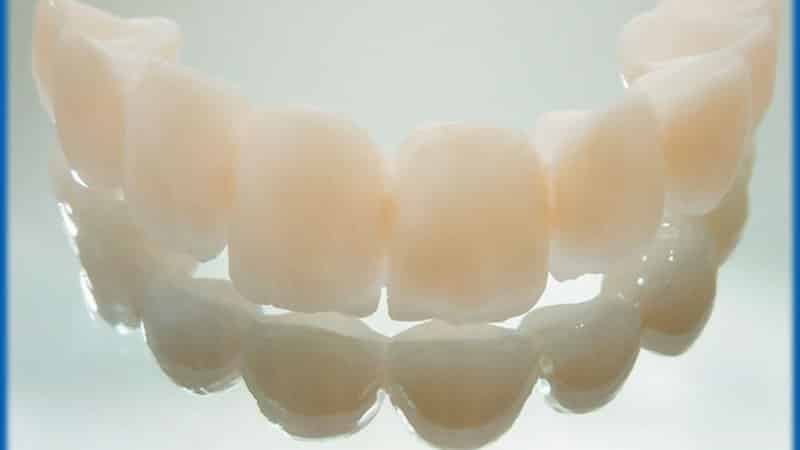 что такое коронка на зуб фото