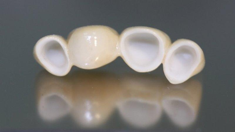 коронки из оксида циркония