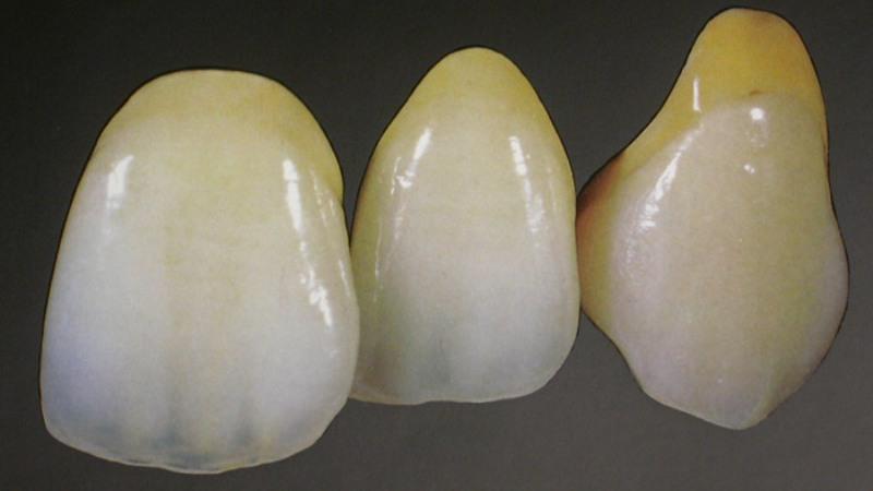 коронки оксид циркония