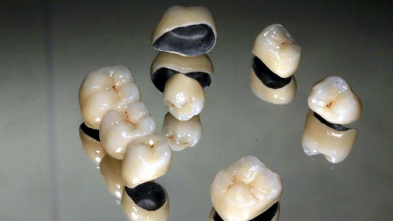 коронки из оксида циркония фото