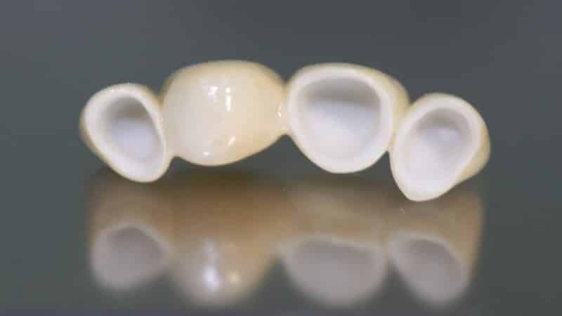 коронки на зубы на передние зубы