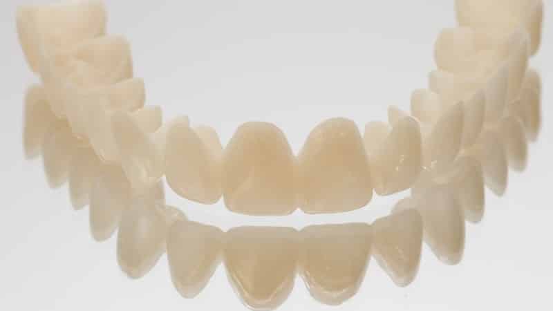 временные коронки на передние зубы фото