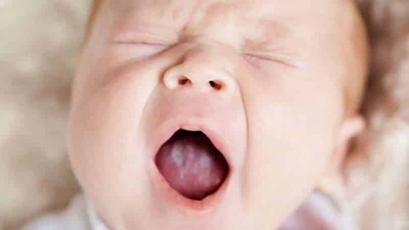 белые прыщики на языке у ребенка