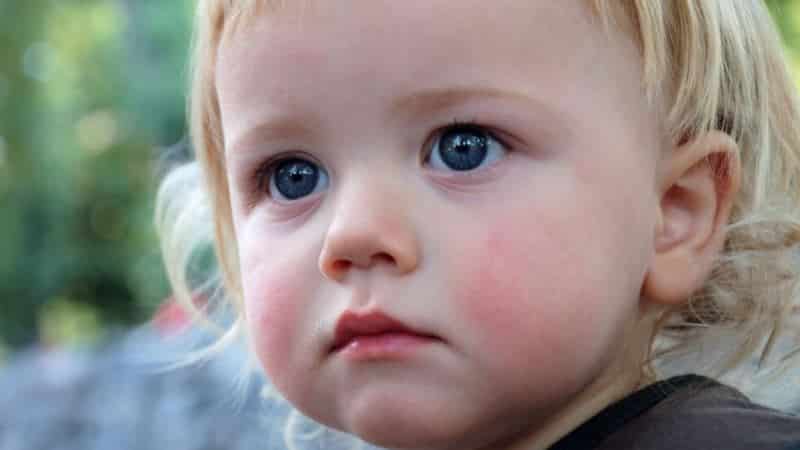 покраснели щеки у ребенка