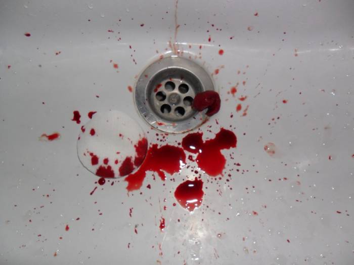 кровь во рту после сна