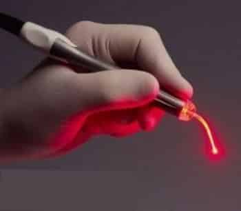 Лазер для лечения зубов Лазер для лечения зубов