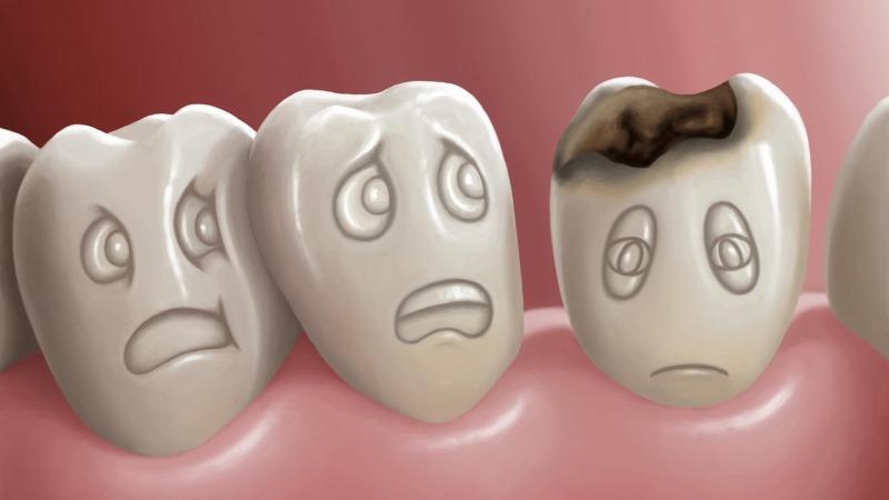 кариес при беременности