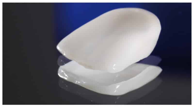 наращивание передних зубов фото до и после