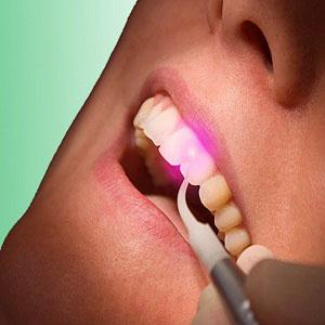 Насколько эффективно лазерное лечение зубов