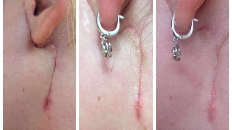 где находятся слюнные железы