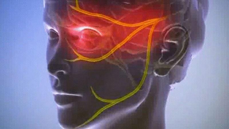 воспаление лицевого нерва симптомы и лечение в домашних условиях