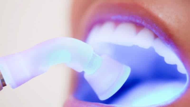 вредна ли перекись водорода для отбеливания зубов