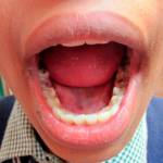 Возможные причины запаха - болезни ротовой полости