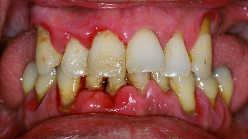 что делает пародонтолог