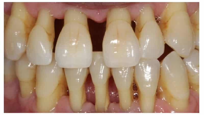 лечение у пародонтолога