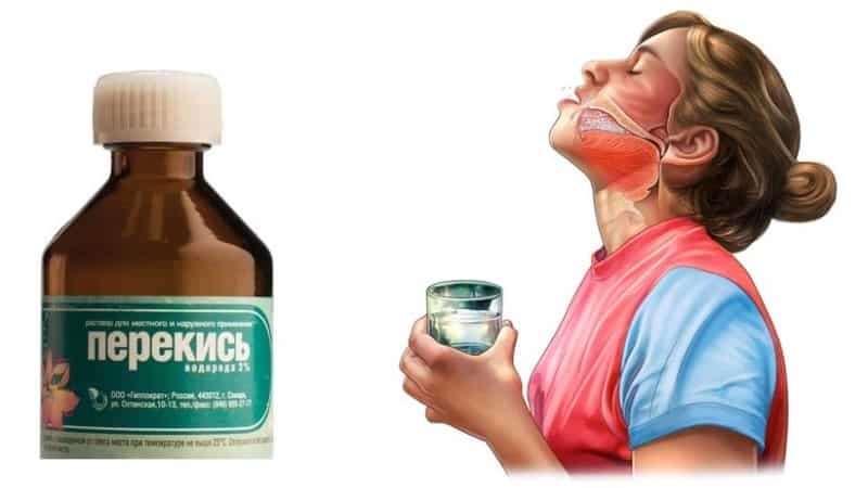 как лечить стоматит перекисью водорода