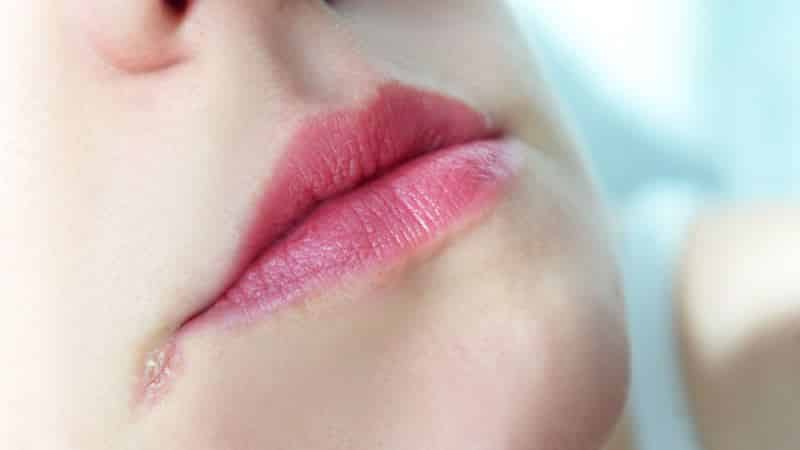 питание при стоматите у детей