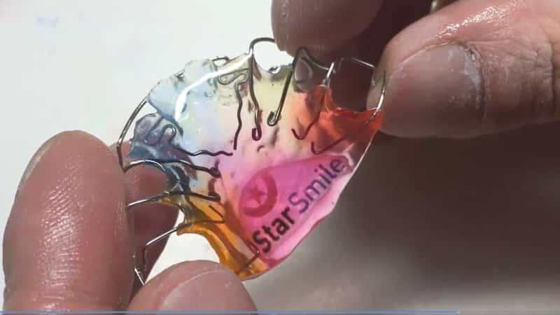 зубные пластины для детей