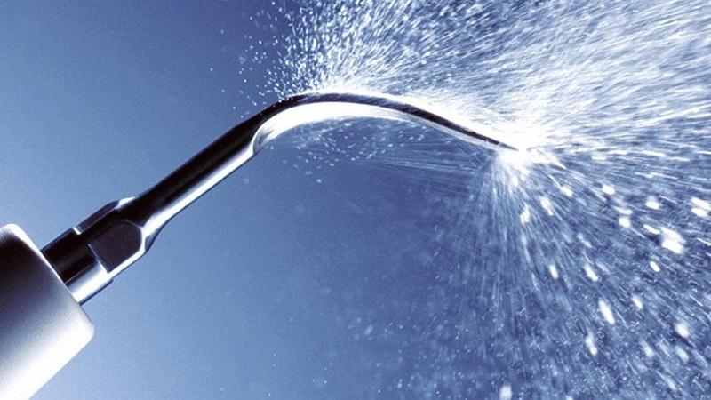 Плюсы и минусы чистки зубов методом Air Flow