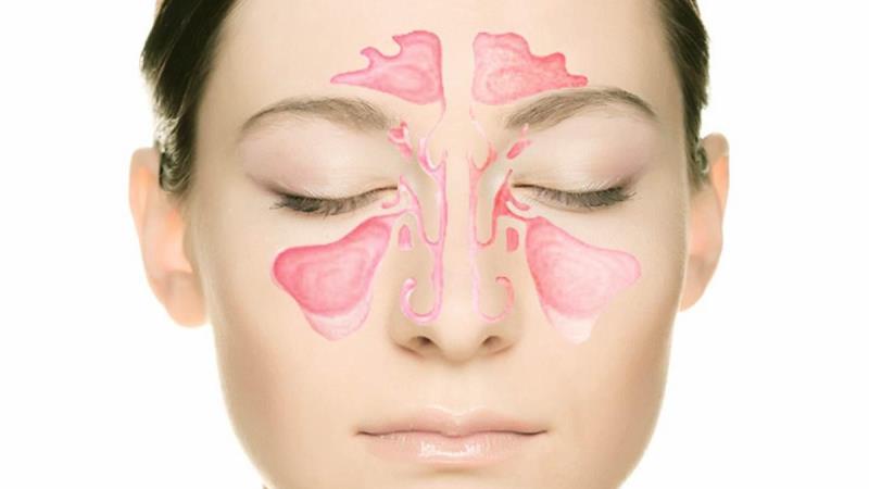 Гайморит – может стать причиной дискомфорта во всей челюсти