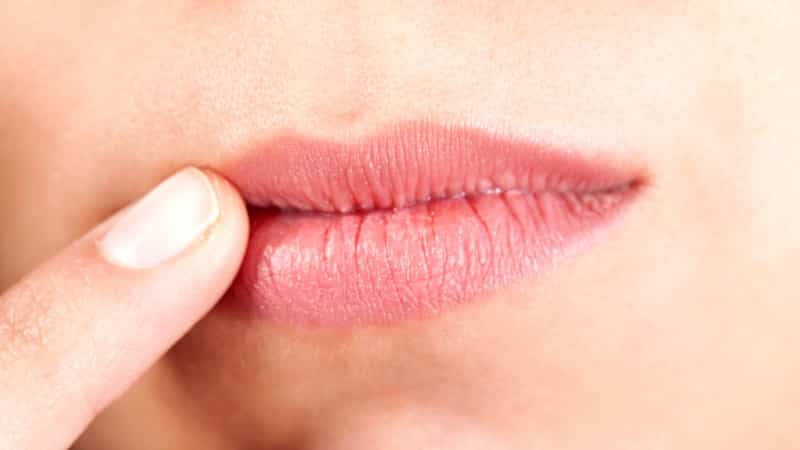 , почему от чего появляются чем лечить трещины в уголках губ у ребенка