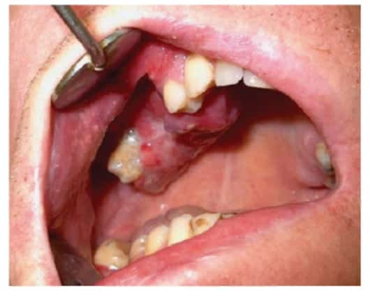 боль в верхней нижней челюсти справа причины