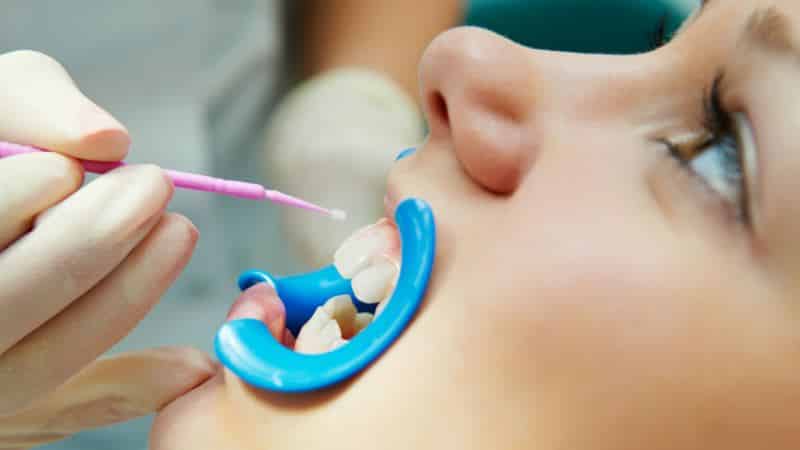 черные зубы у взрослых