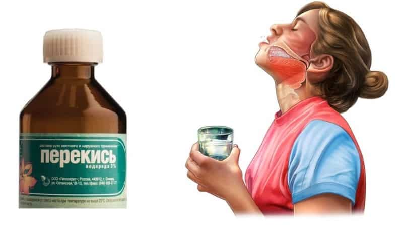 можно ли перекисью полоскать рот