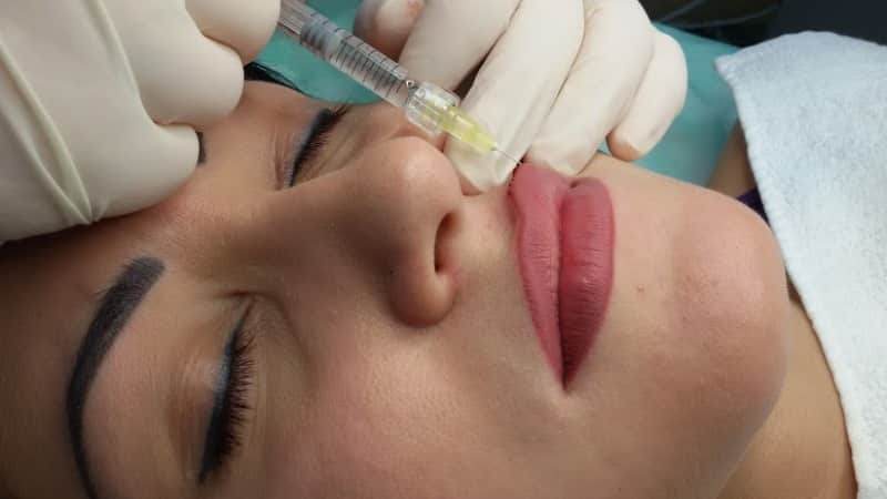 уход за губами после инъекций гиалуроновой кислоты