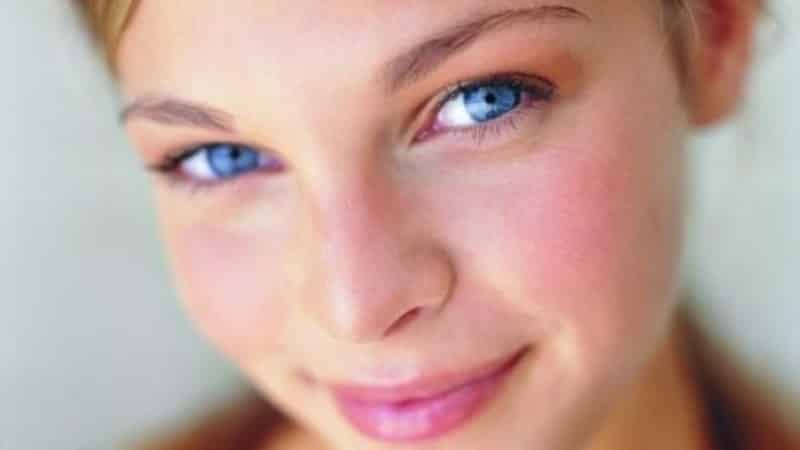 постоянно красне щеки у взрослого причины