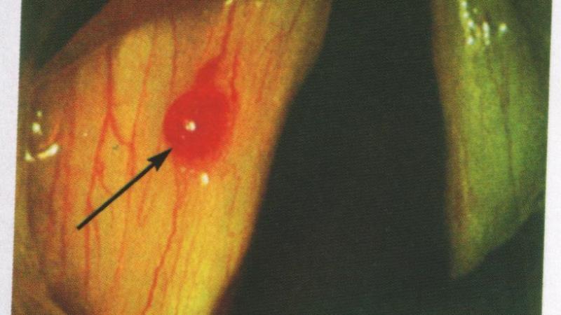 шишка во рту на небе фото