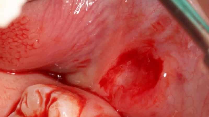 poyavilaна небе шишка что этоs-shishka-na-nebe-vo-rtu-prichiny- 4