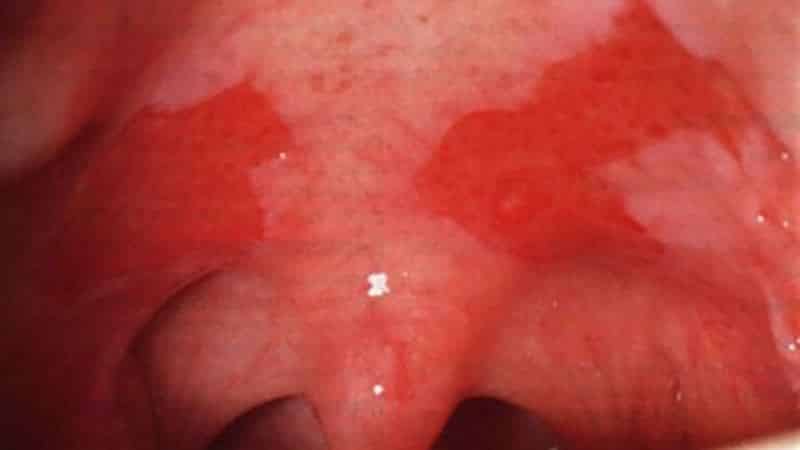 на небе вскочила шишка